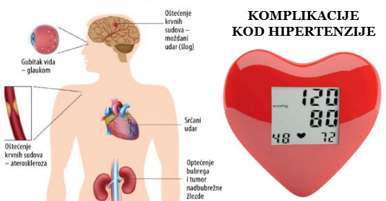 hipertenzija simptomi koje ne smete zanemariti